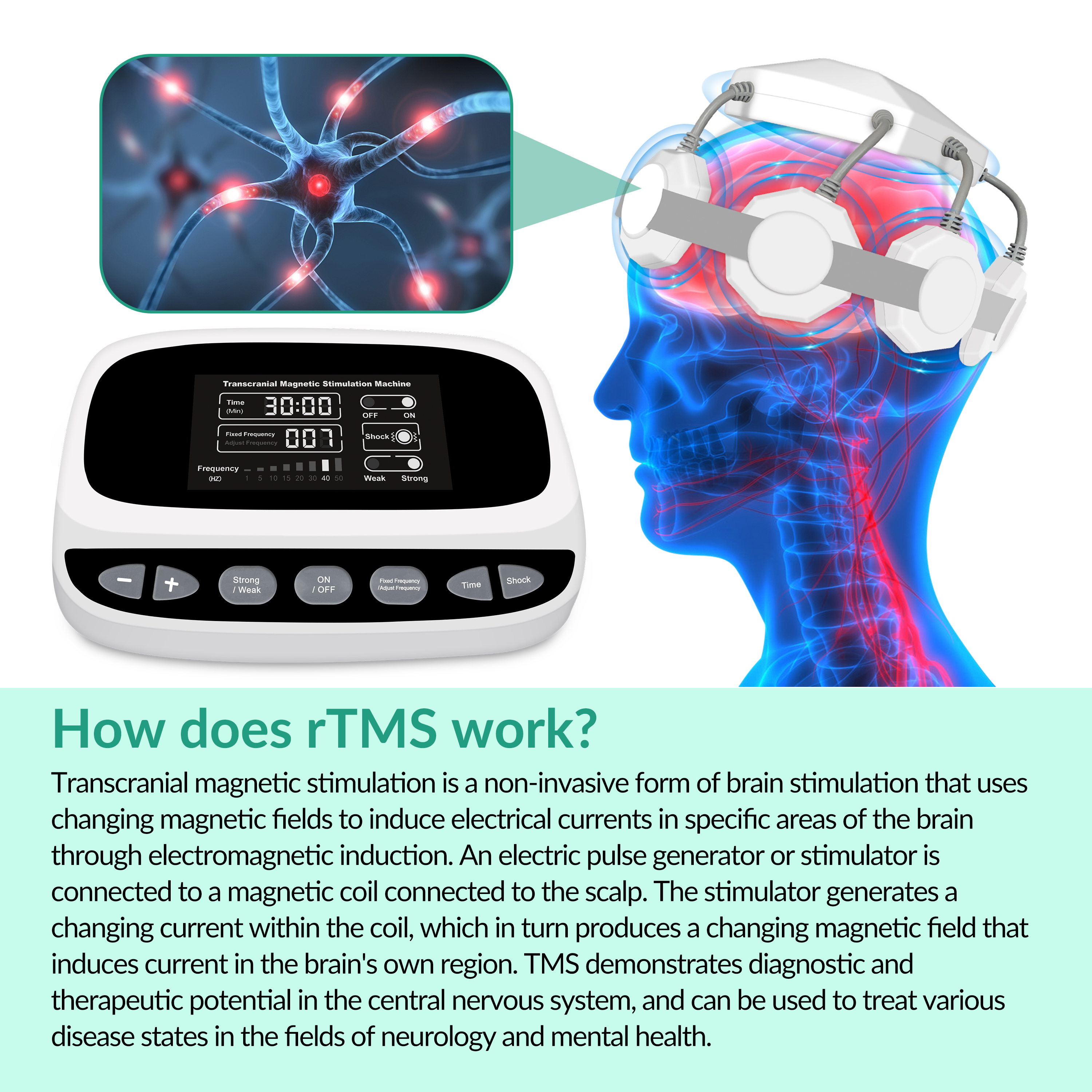 ZJZKTOP Portable TMS rTMS Magn - Home Office Equipment บทวิจารณ์และราคา